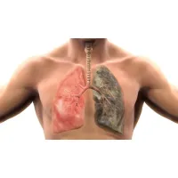 Как бросить курить?