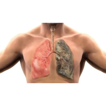  Як кинути палити?